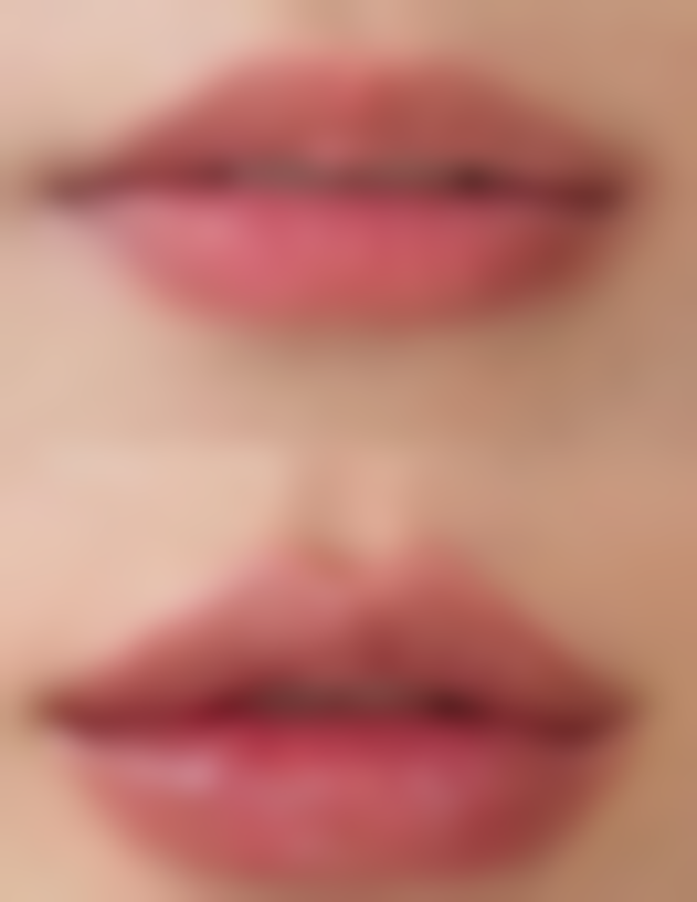 如何攻克顽固下眼袋？不同治疗方法对比与选择