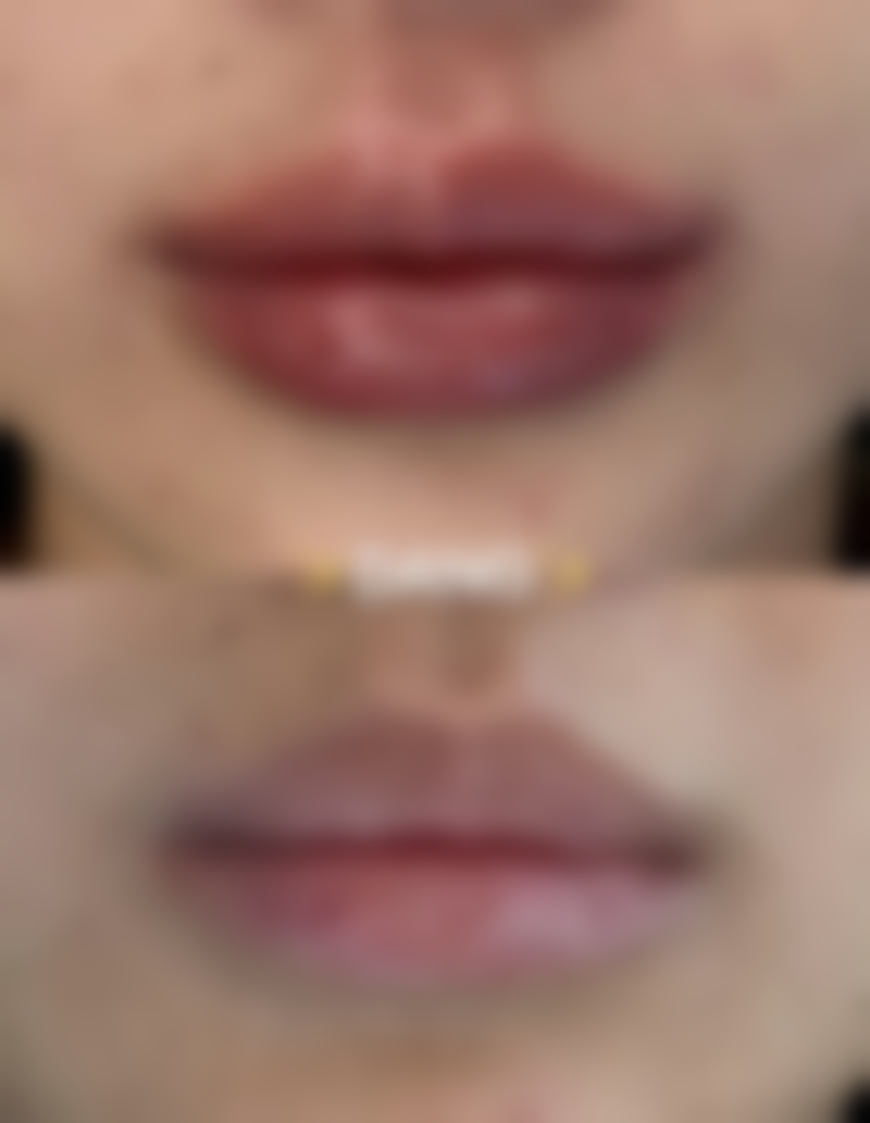 三、广东药学院附属医院激光整形美容中 心医生介绍: