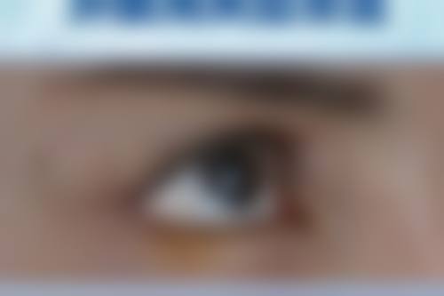 四、兰州陈晨中医针灸美容诊所实例