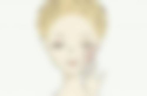 埋线、微创、全切双眼皮手术恢复时间大揭秘，教你加速恢复美美蜕变！ 