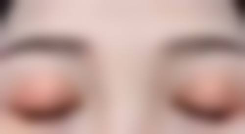 五、广州海珠今生整形医疗实例