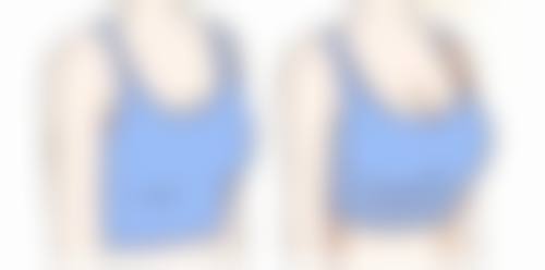 四、唐山润泽颜整形医院实例