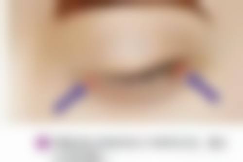 五、南京美吉拉医疗美容诊所怎么预约：