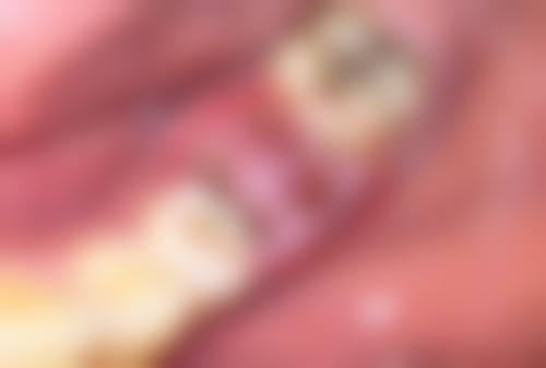 五、太原爱可医疗美容实例