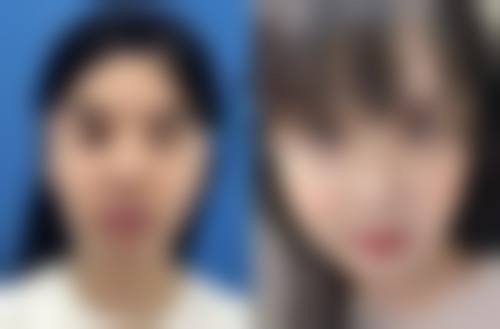 四、西安瑞丽诗医疗美容诊所实例