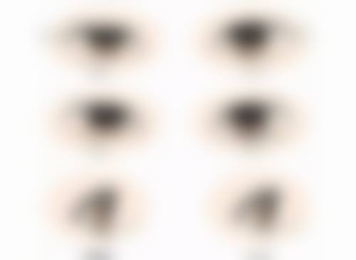 40年烧伤疤痕修复攻略：综合方案改善外观功能，多手段助力重拾皮肤平整自信 