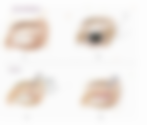 怎样去除疤痕体质?保持耐心是关键