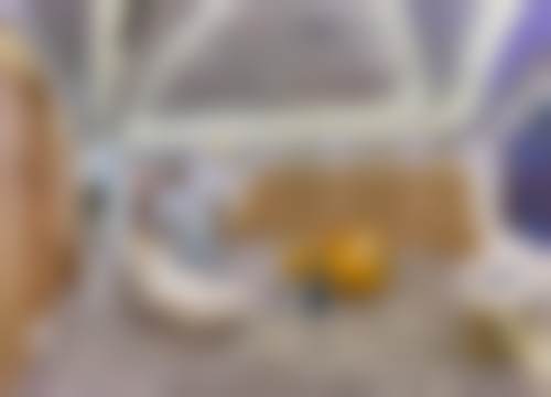 翟宇东玻尿酸注射实例