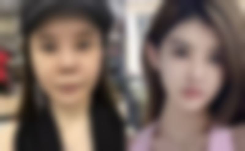 五、长沙素妍医疗美容医院实例