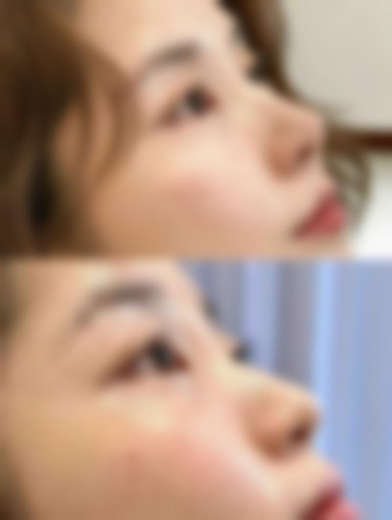 怎样去除疤痕体质?日常护理不可少