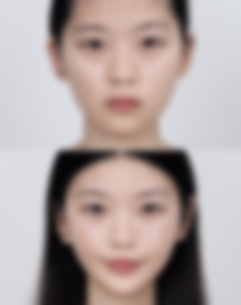 七、中山市人民医院整形美容科价格表：（仅供参考）