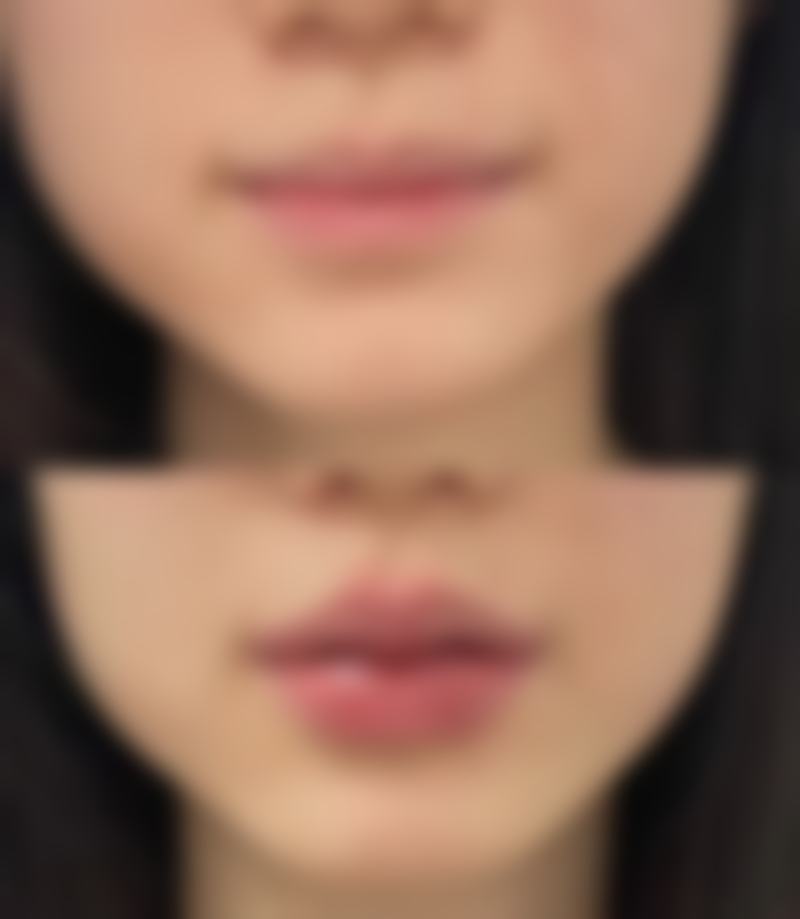 二、宜兴市人民医院医疗美容科正规吗？来看看医院资质：