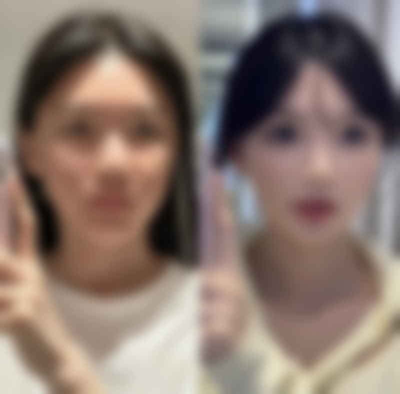 抽脂手术康复时间大揭秘！1 - 3 个月基本恢复，6 - 1 年完全稳定有诀窍 