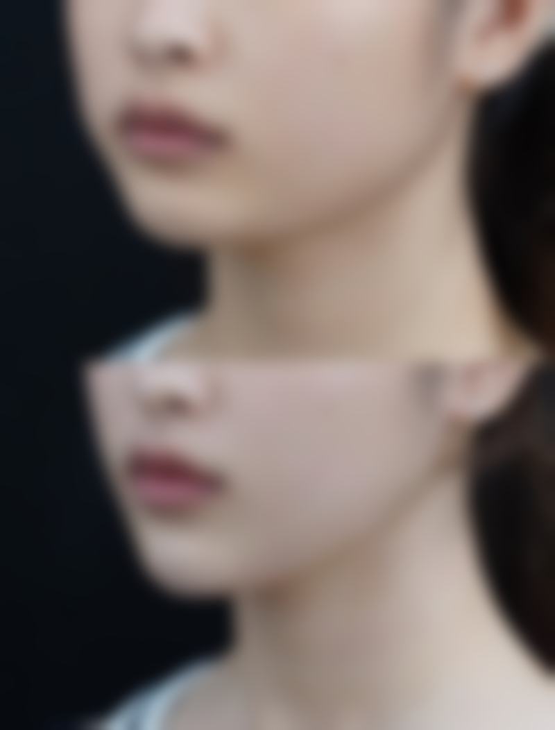 五、上饶市双博医疗美容怎么预约：