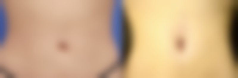 二、松滋鼎极整形医院正规吗？来看看医院资质：