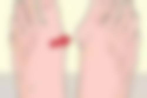 隆鼻的骨粉揭秘：羟基磷灰石人工骨填充的风险