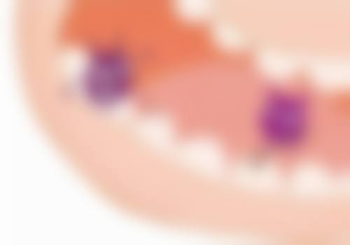 海口爱牙口腔医院矫正牙齿效果咋样？先进技术与个性化方案让矫正更高效 