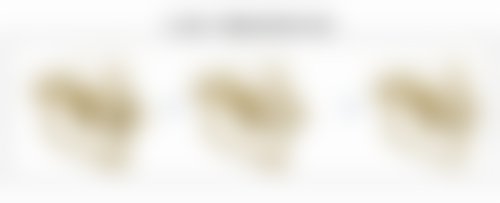 告别重度眼袋有妙招：多样治疗方案，满足不同需求