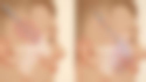 四、济南黄杰整形医院实例