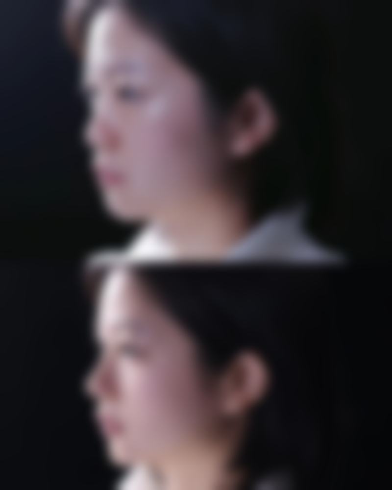 四、威海泡泡微笑医疗美容诊所实例