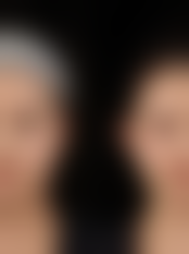 七、济南黄杰整形医院真实的顾客评价如下: