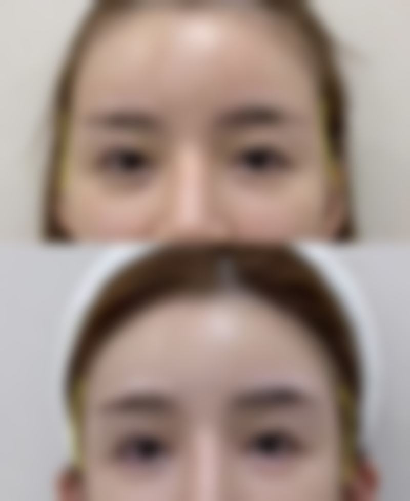 七、武汉爱美仕（慧丽源）医疗美容诊所真实的顾客评价如下：