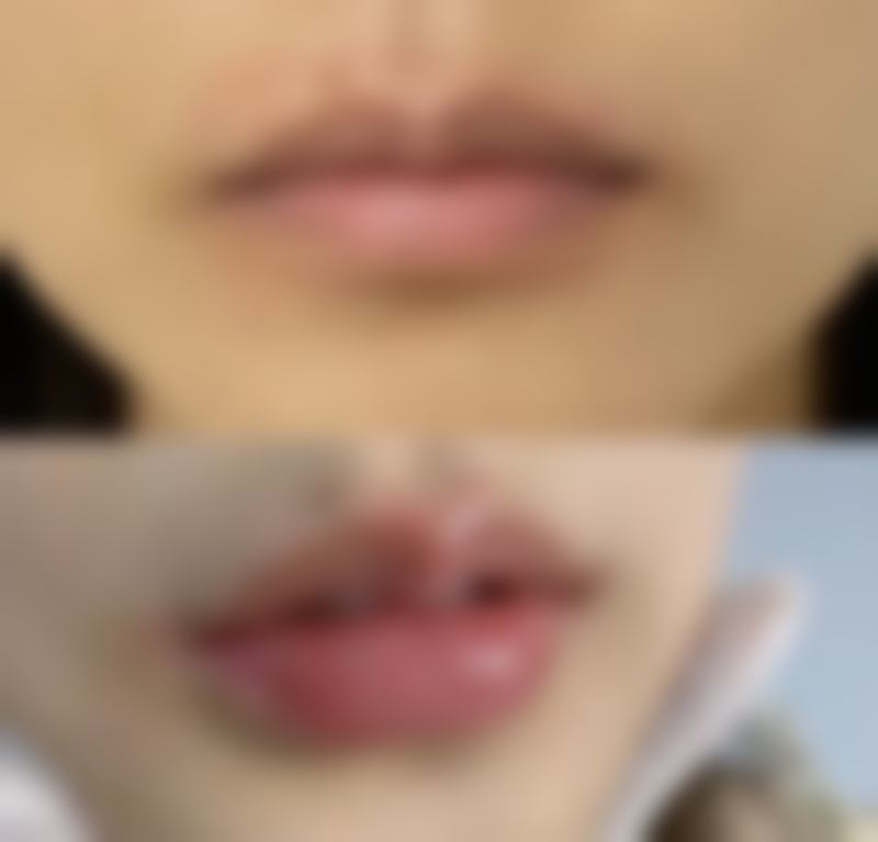 六、威海泡泡微笑医疗美容诊所价格表：（仅供参考）