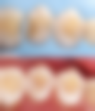 海口爱牙口腔医院矫正牙齿成效咋样？价格与口碑情况