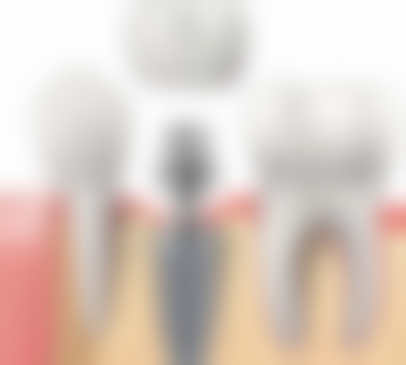 海口爱牙口腔医院矫正牙齿成效咋样？医生团队优势