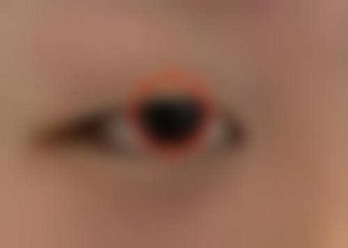 哪些因素影响大臂抽脂见成效的时间？个体差异有别