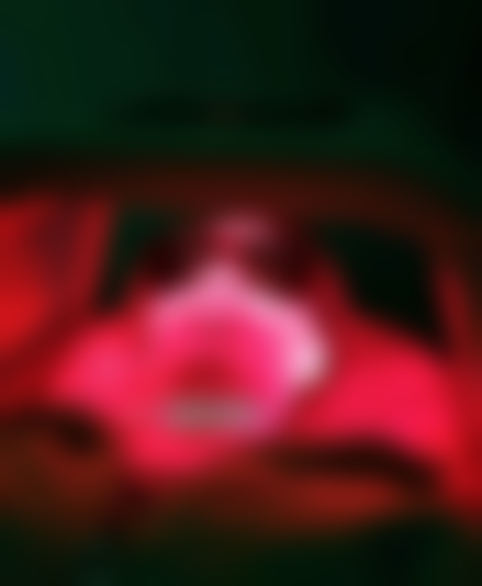 我亲测反复长痘闭口 深圳米兰柏羽红蓝光祛痘 刷酸后两百多半个月没复发