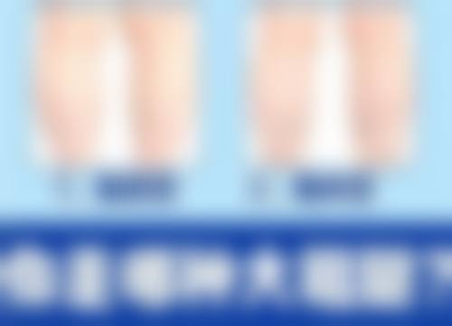 去眼袋攻略：手术治疗中重度眼袋