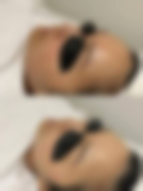 文武果酸换肤水平怎么样可靠吗？