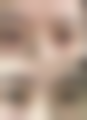 正规医院：打瘦脸针的安心保护