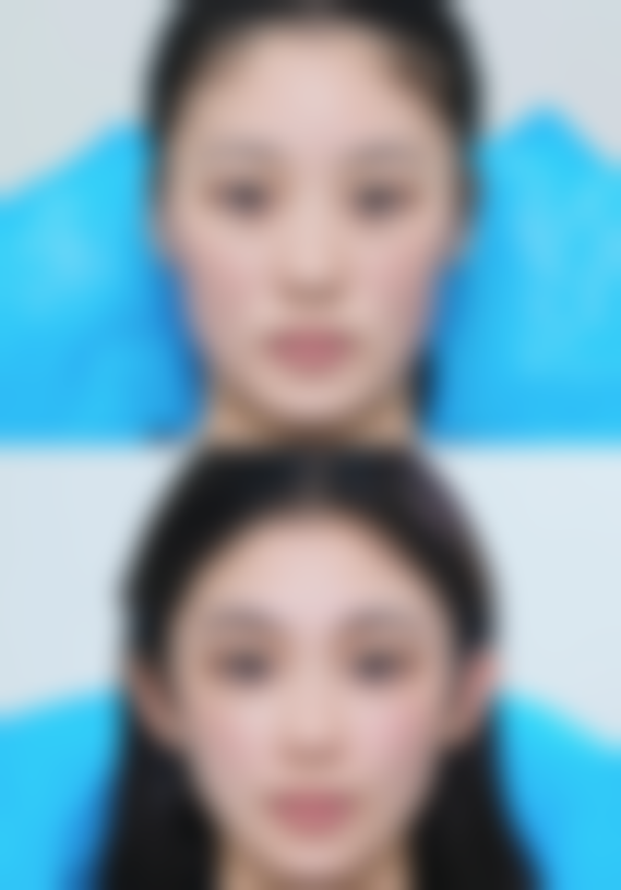 五、上海交通大学医学附属瑞金医院灼伤整形科实例