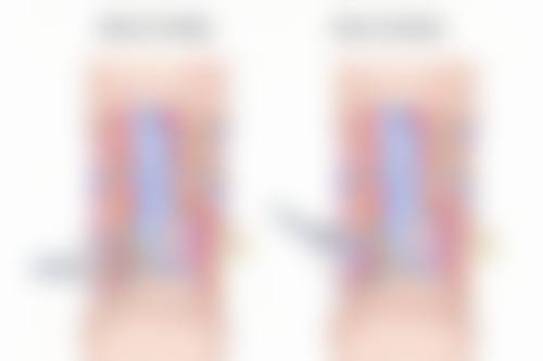 五、淮安艾米丽整形医院怎么预约：