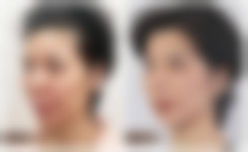 二、佛山幻都荣恩整形美容医院正规吗？来看看医院资质：