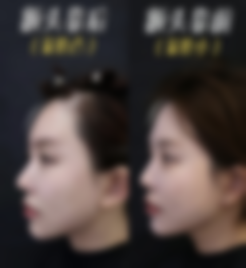 七、承德瀚美医疗整形美容诊所真实的顾客评价如下：