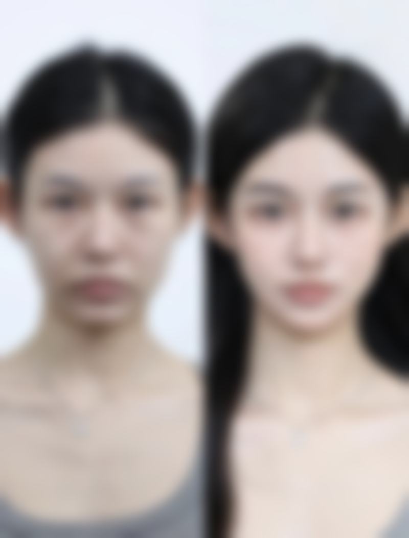 六、鸡西乐华医疗美容诊所价格表：（仅供参考）