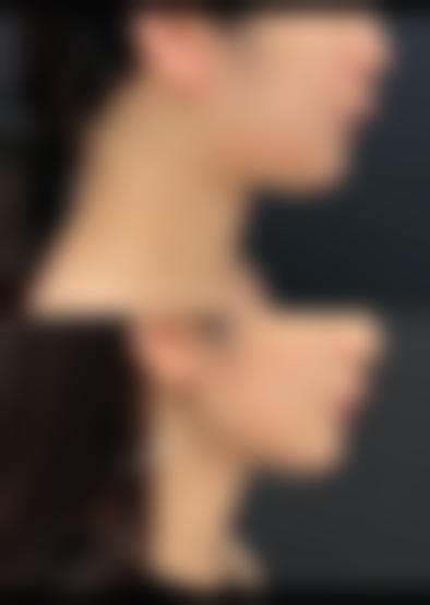 五、淮北相山天使医疗美容整形医院实例