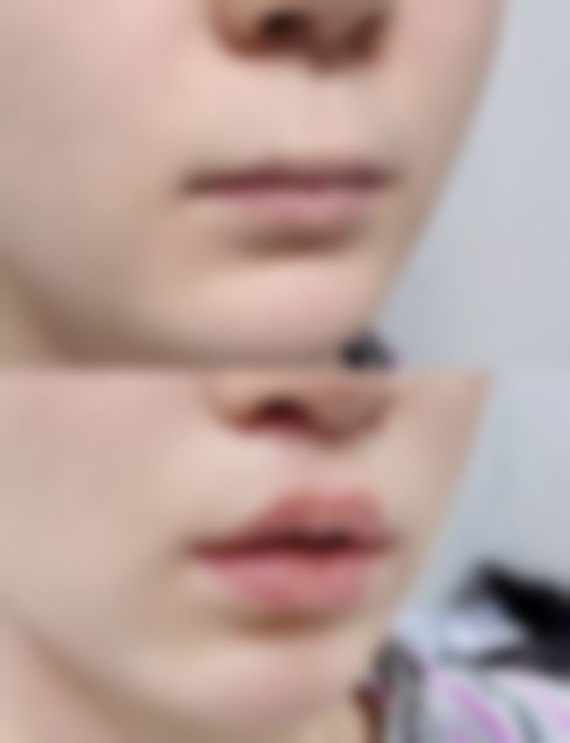 三、狎鸥亭MK整形外科医生介绍: