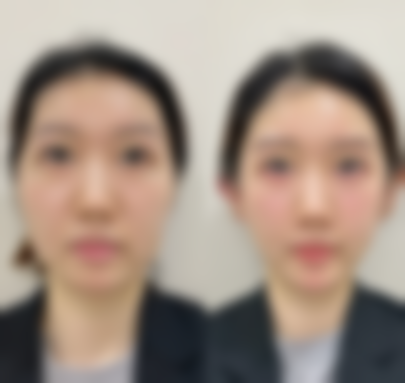 五、鸡西乐华医疗美容诊所怎么预约：