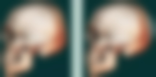 三、韩国dr.bone整形外科医生介绍: