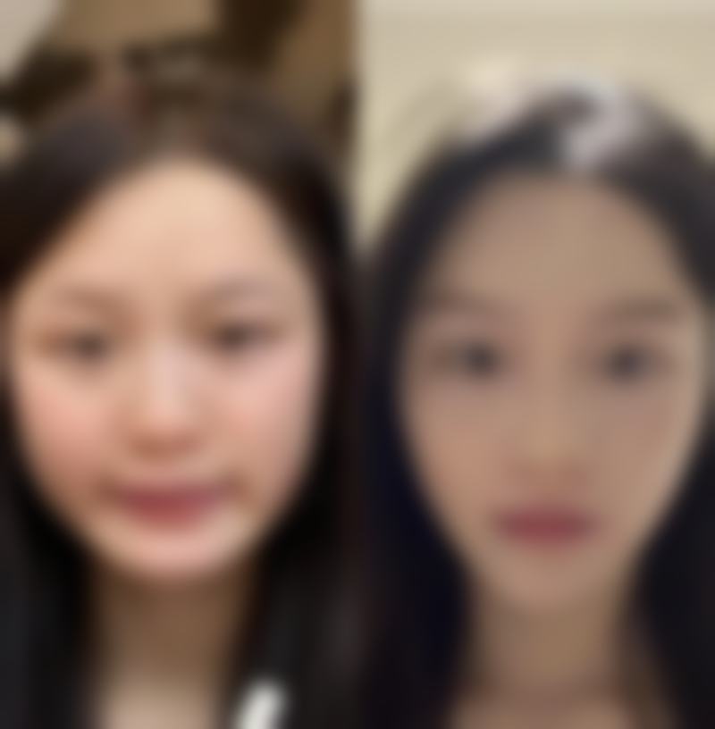 四、重庆三一八医院整形疤痕科实例