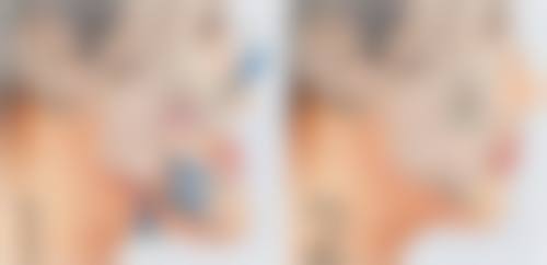 八、郴州市瑞澜医疗美容医院真实的顾客评价如下：