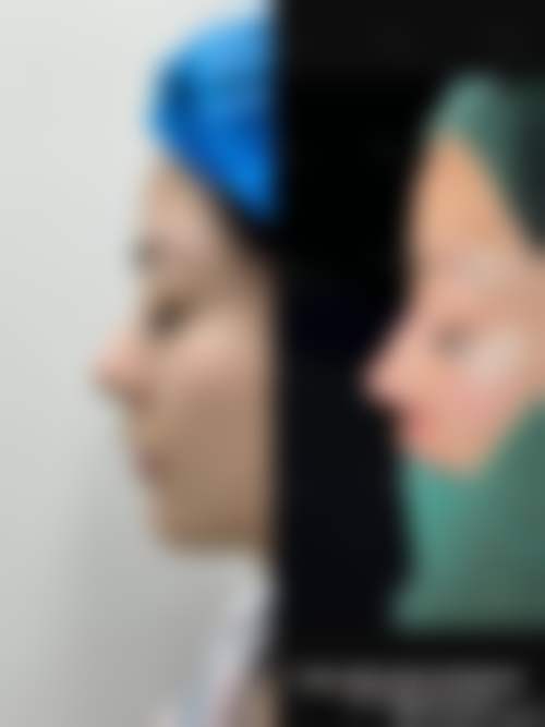 六、上海德媛安芯美医疗美容诊所价格表：（仅供参考）