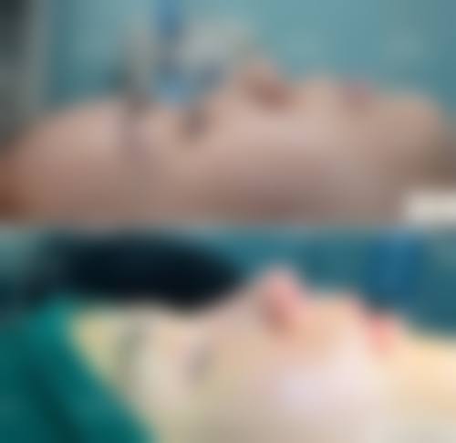 张敬德医生隆胸怎么样可靠吗？