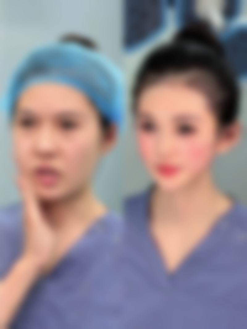 女人有眼袋不用怕，手术治疗成效佳