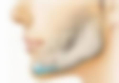 宝尼达隆鼻加速修复小妙招大公开