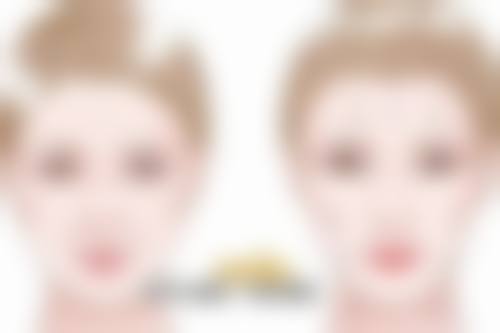 隆胸后假体移位啥感觉？看看改善建议